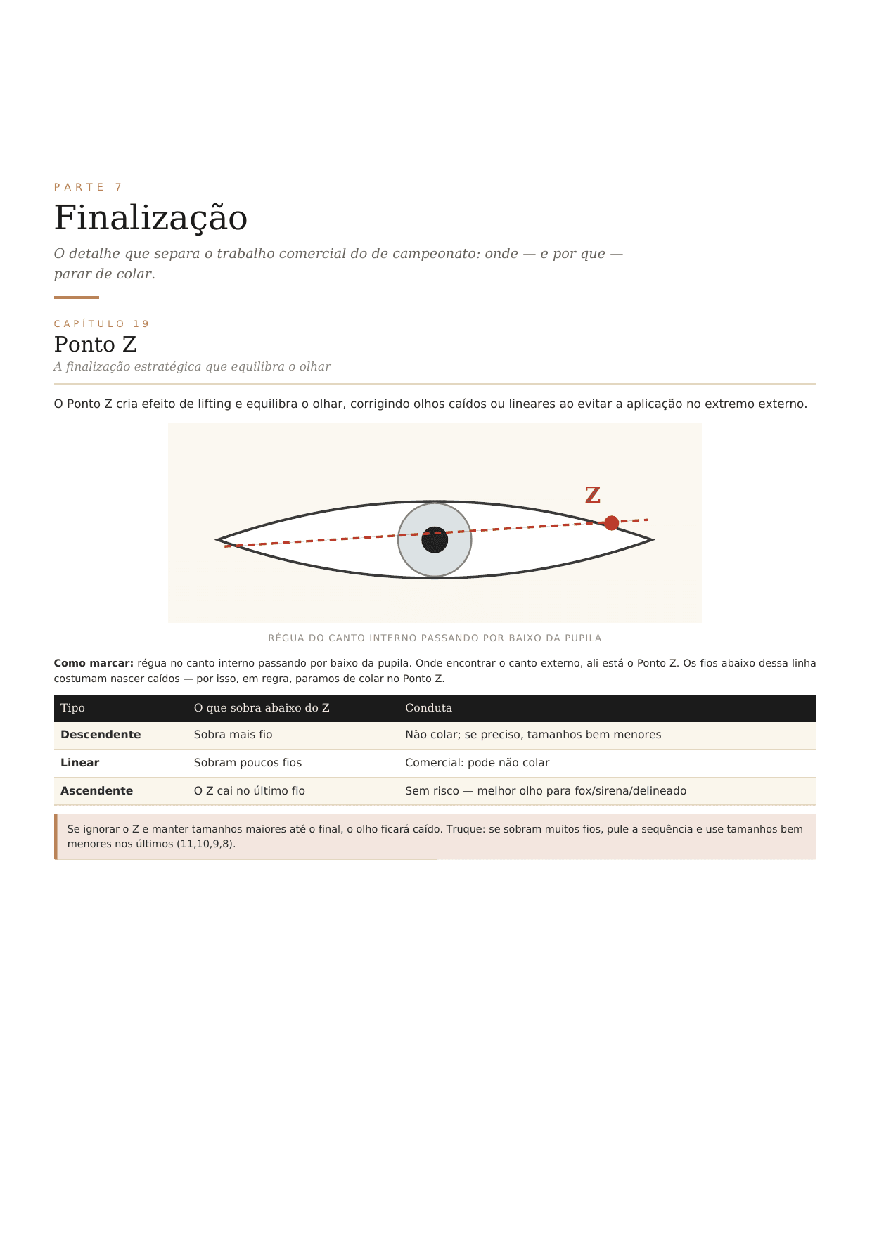 El Punto Z: dónde dejar de pegar
